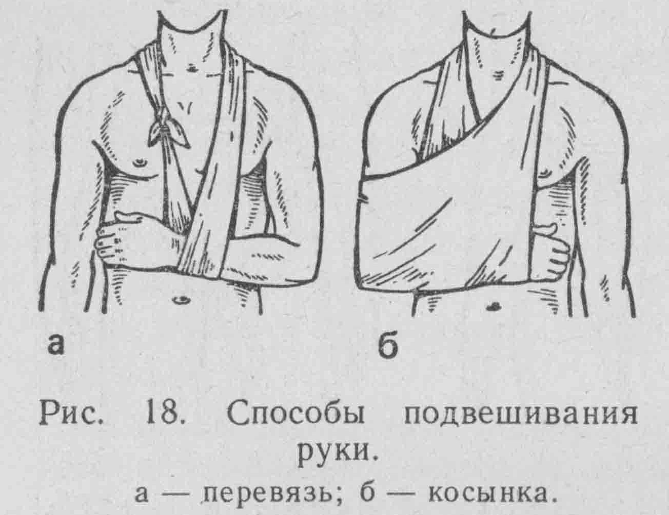 Химический ожог руки после химиотерапии