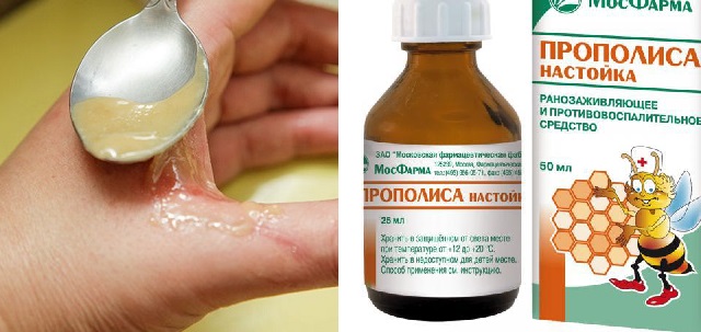 Рецепты от ожогов с прополисом