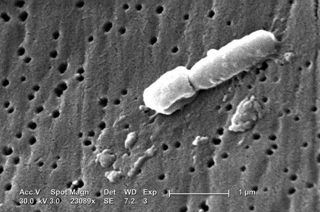 Можно ли не чувствовать пневмонию