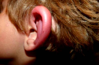 Отек уха происходит по разным причинам Отек уха