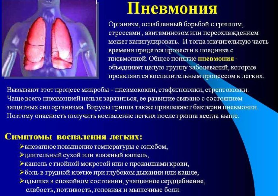 Пневмония