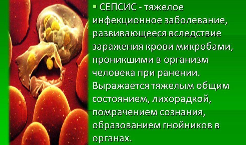 Сепсис