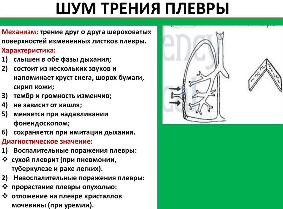 Звук трения плевры