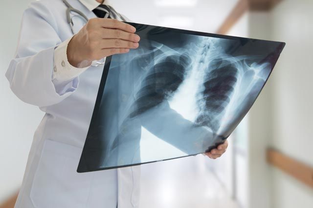 Климат для болеющих бронхитом и пневмонией