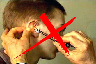 При сильном кровотечении не закладывать в ухо ватные турунды Новообразования