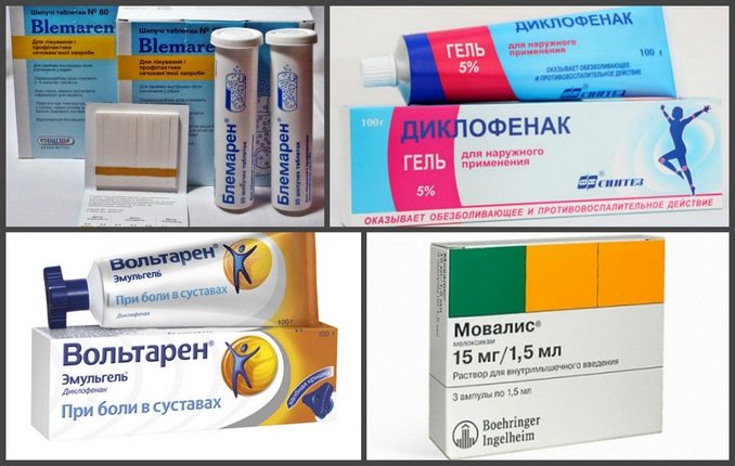 Препараты для лечения подагры Лекарства от подагры