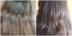 Ожог кожи при покраске волос