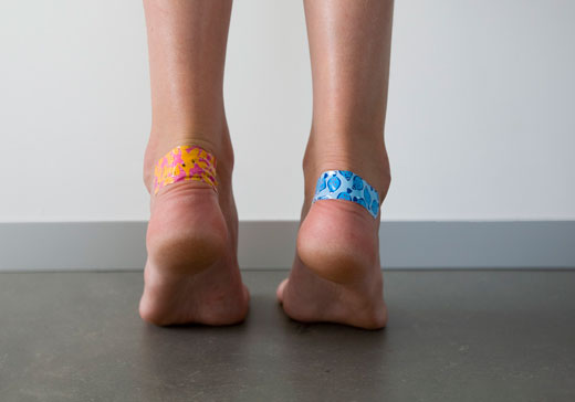 Пластырь на ноге от мозолей