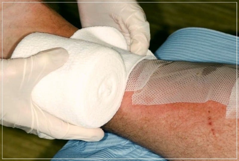 Чем и как лечить ожог в домашних условиях 3 сильные ожоги ног