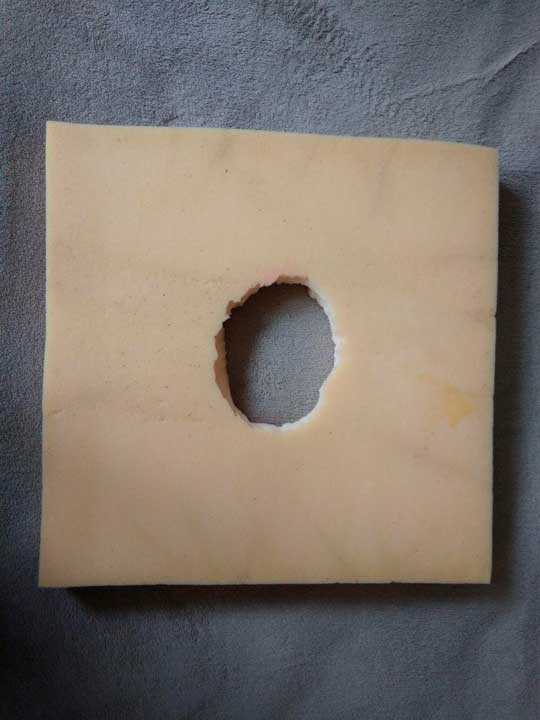 Как быстро вылечить пролежень на бедре