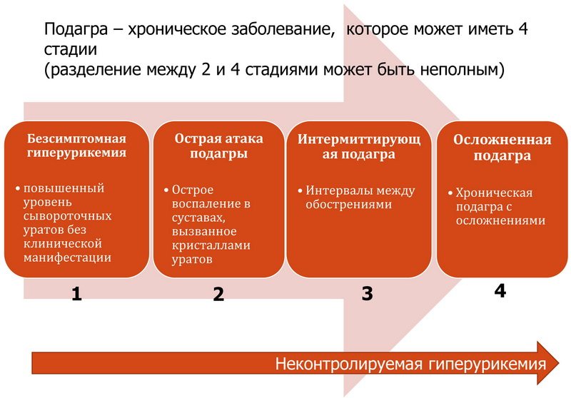 Как убрать подагру на ногах