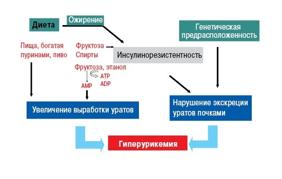 Образование подагры Образование подагры