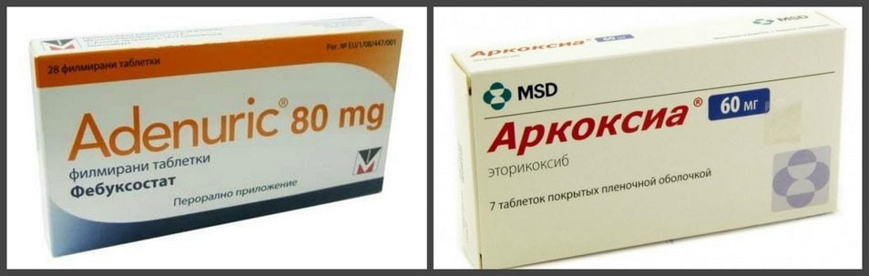 Препараты для лечения подагры нового поколения Новые препараты от подагры