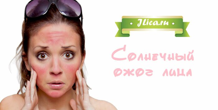 солнечный ожог лица солнечный ожог лица