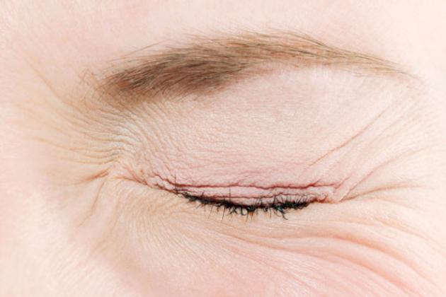 Травма глаза Закрытый глаз