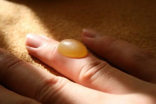 При ожоге волдырь лопнул что делать При ожоге волдырь лопнул что делать thumbnail